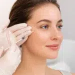Botox Around Eyes treatment softening crow’s feet at the outer corners of the eyes